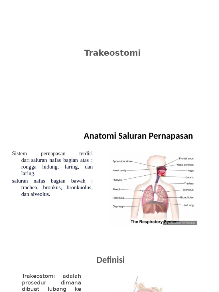 Panduan Lengkap Trakeostomi dan Indikasinya | PDF
