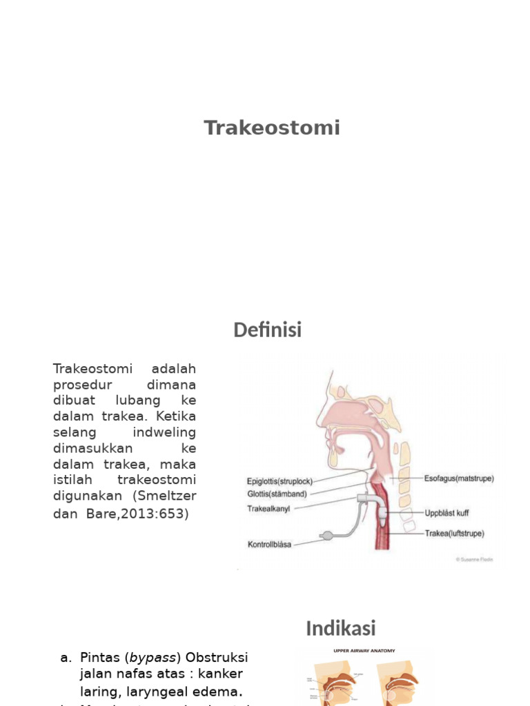 Panduan Lengkap Trakeostomi dan Indikasinya | PDF