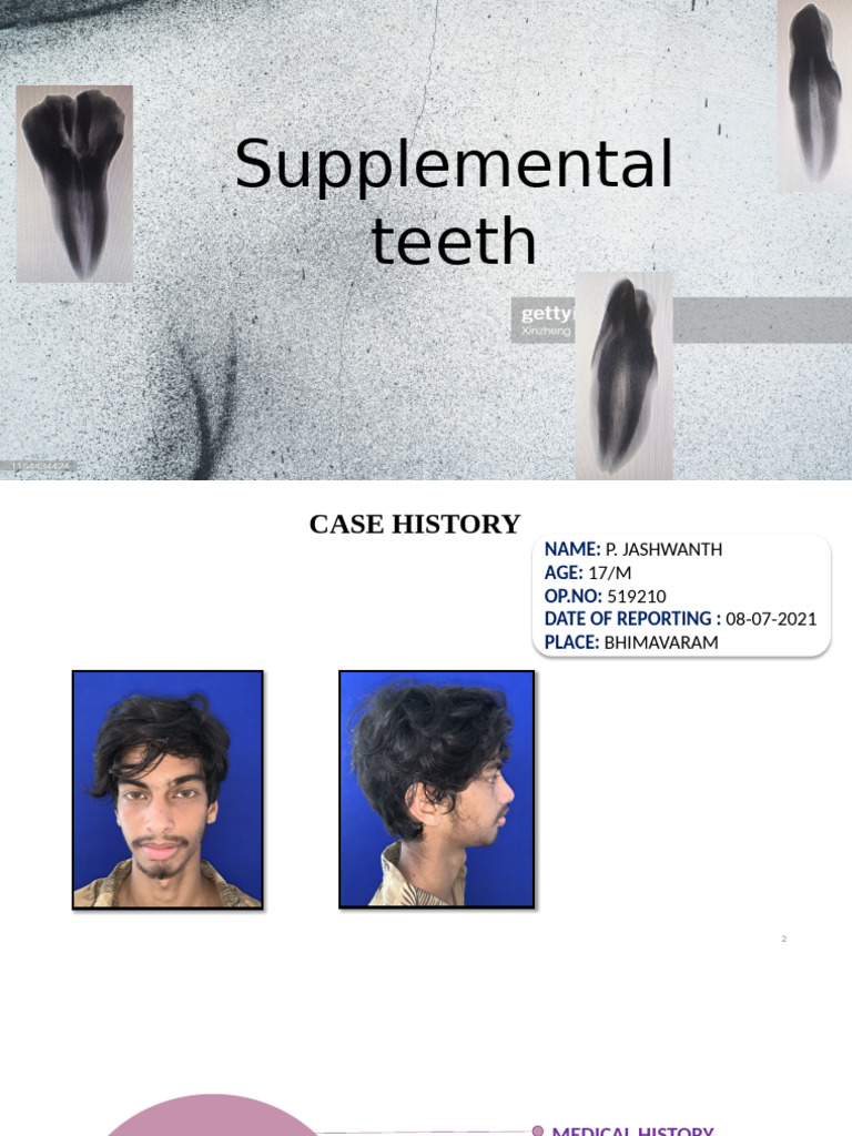 Case Study: Supplemental Teeth Analysis | PDF | Dental Anatomy | Tooth