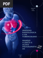 Nódulo de Ghon e Complexo de Ranke | PDF | Tuberculose | Mycobacterium ...