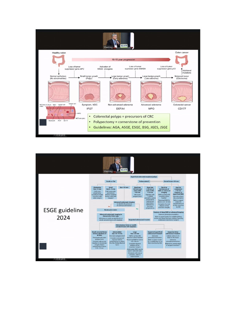 Colon Polyp Management | PDF
