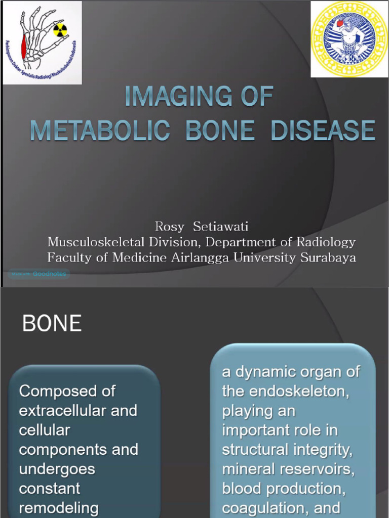 Imaging of Metabolic Bone Disease | PDF