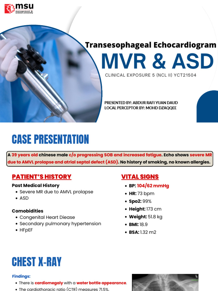 Abdur Rafi - Tee Asd + MVR (Nicl) | PDF | Heart | Heart Valve