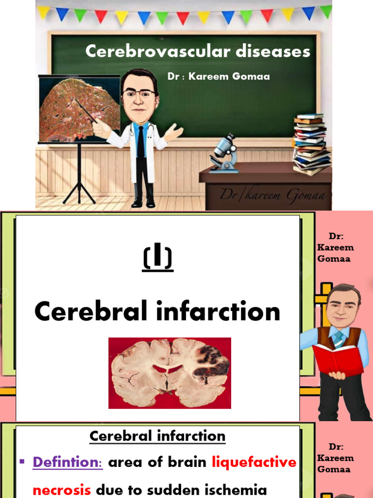 L3 Pathology Cerebrovascular Disease (Nervous System 2) | PDF ...