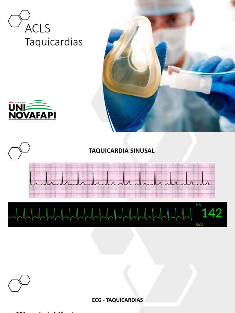 Algoritmo de Taquicardia para Adultos Com Pulso | PDF | Choque ...