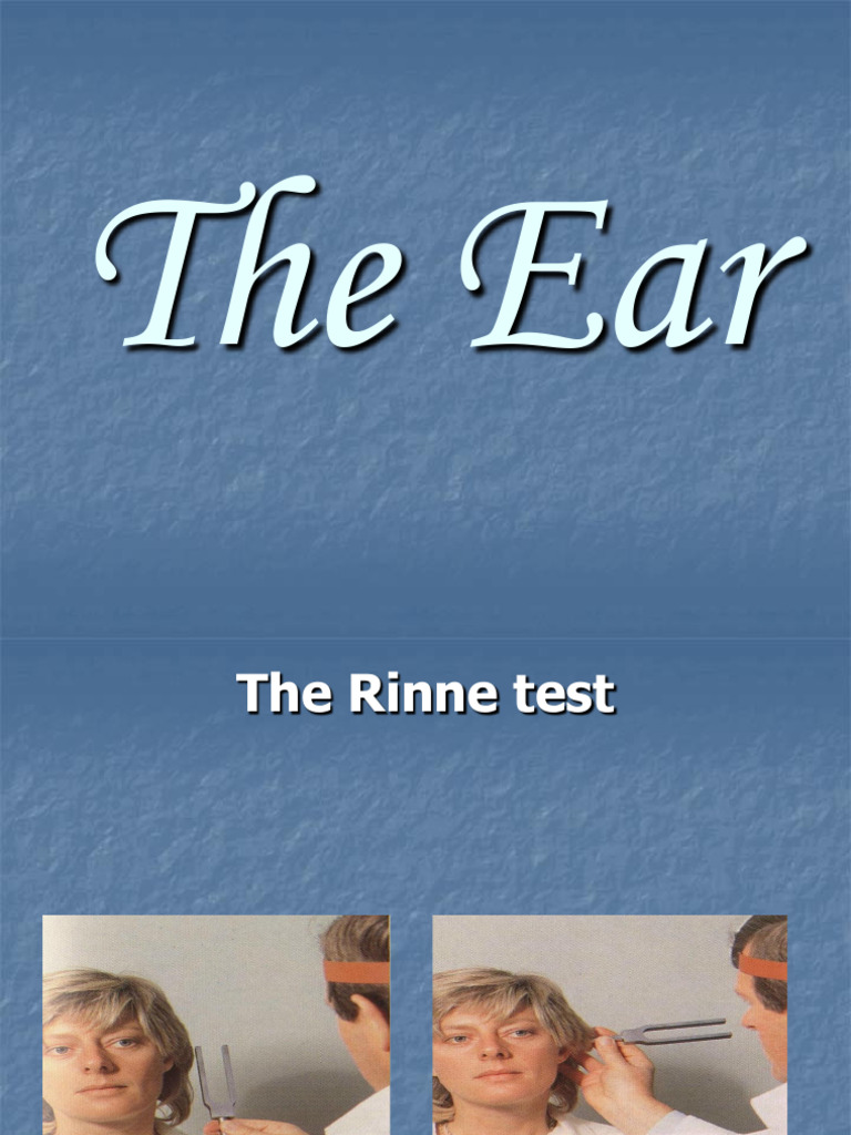 Rinne and Weber Tests for Hearing Loss | PDF | Senses | Human Head And Neck
