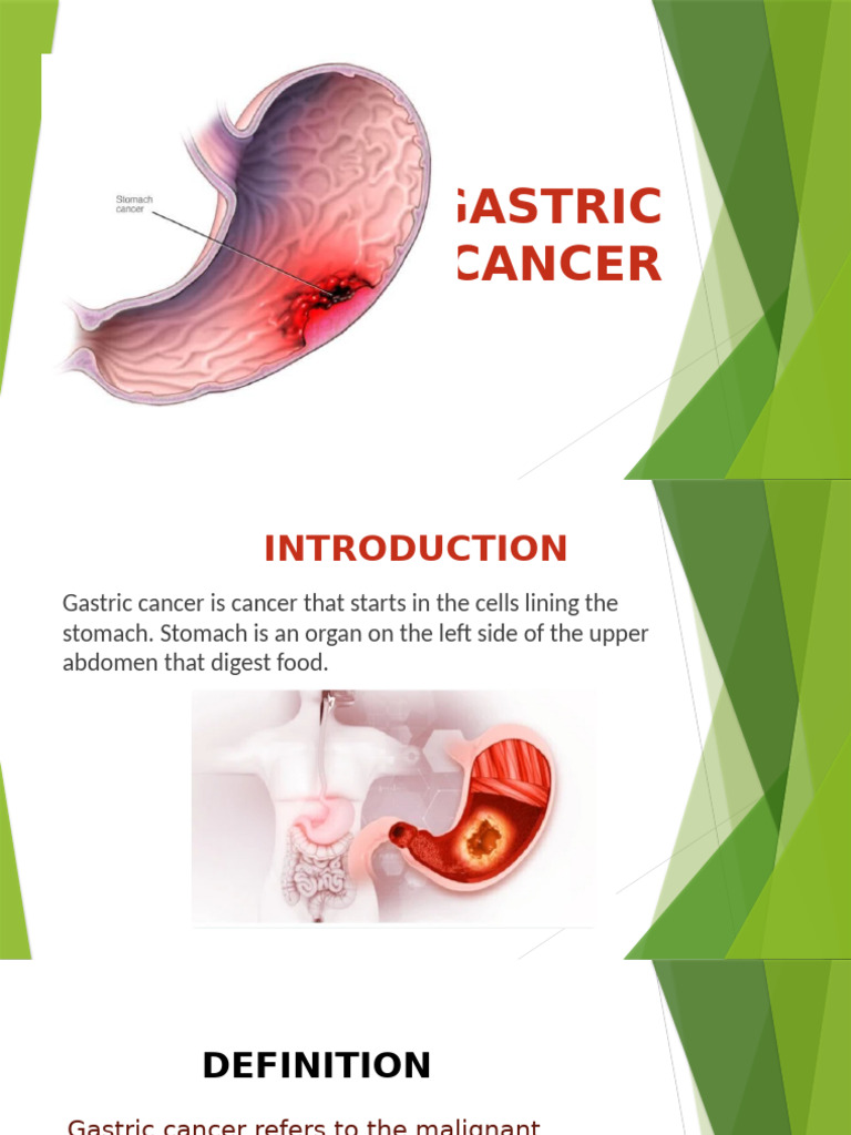 Understanding Gastric Cancer Risks | PDF | Neoplasms | Clinical Medicine