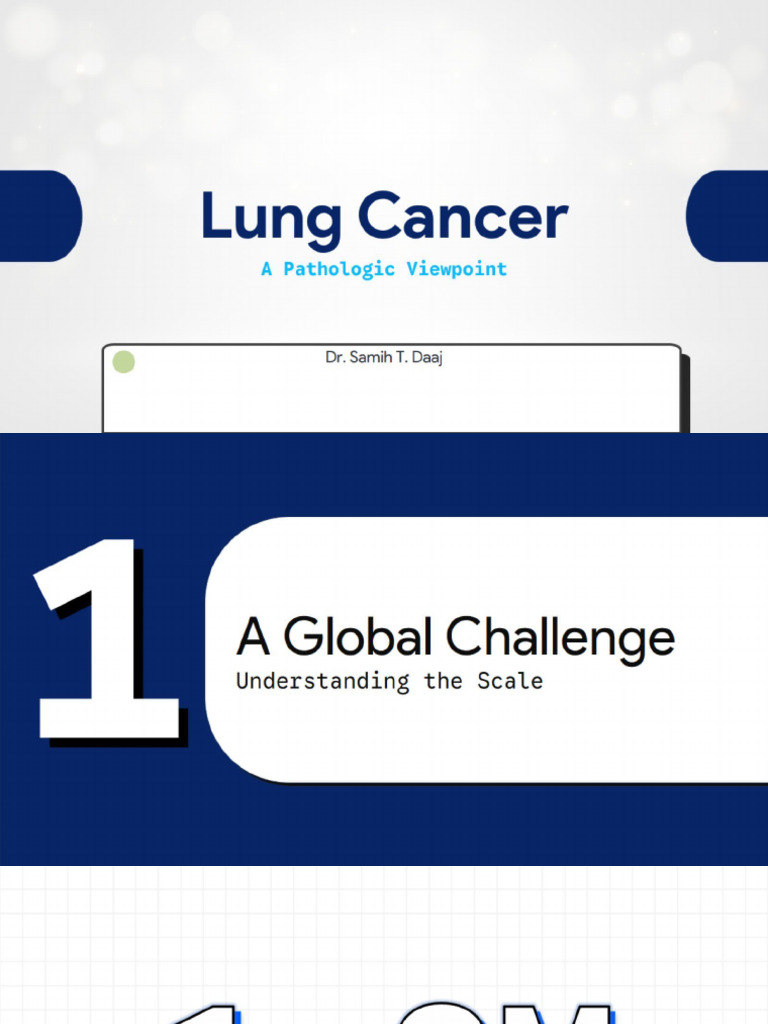 Lung Cancer | PDF | Cancer | Lung Cancer