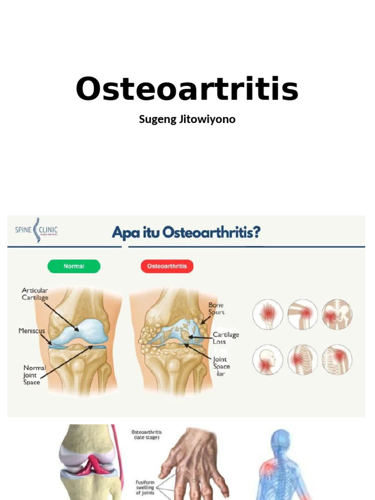 Osteo Art Ritis | PDF