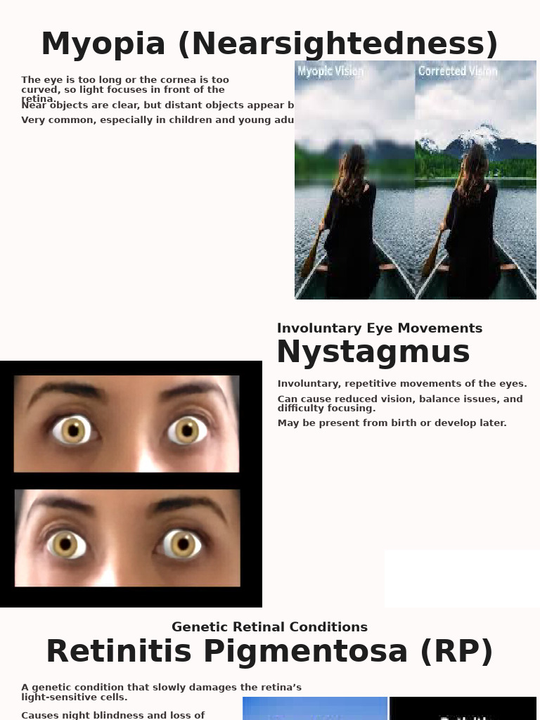 Common Eye Conditions Explained | PDF