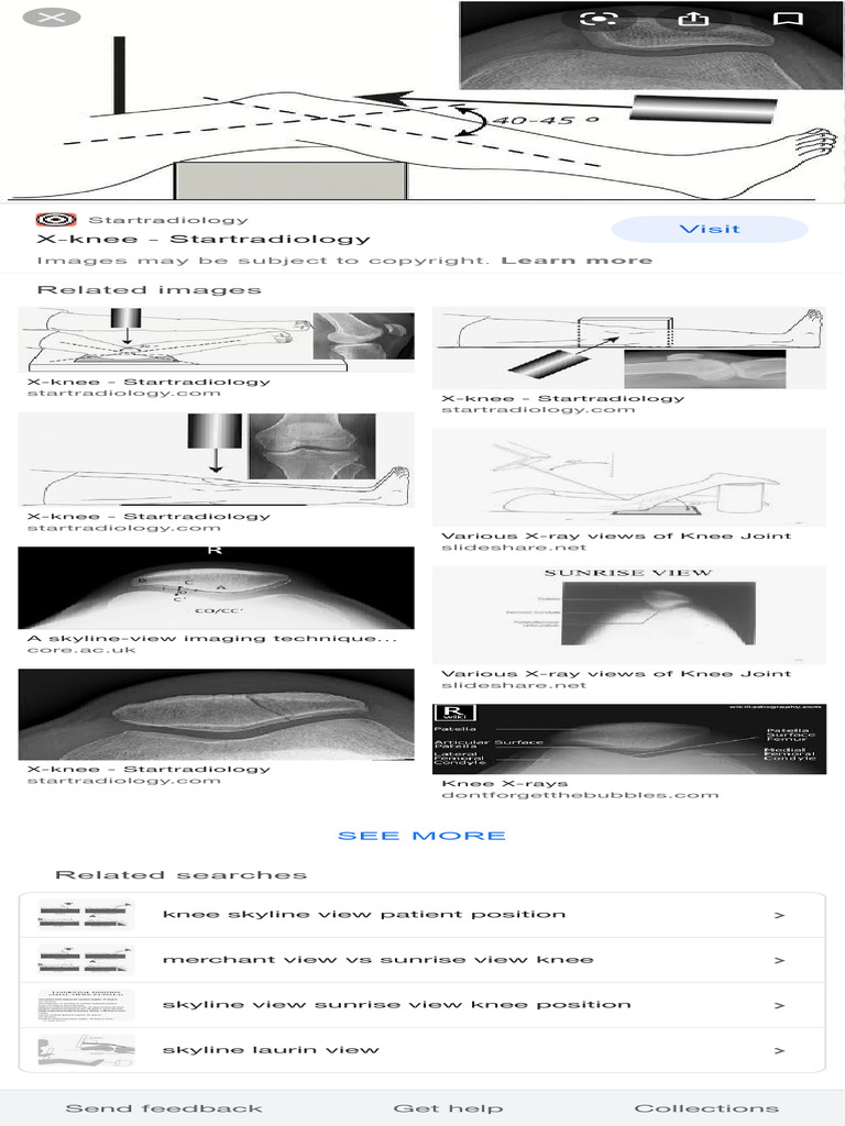 Skyline View X Ray - Google Search | PDF