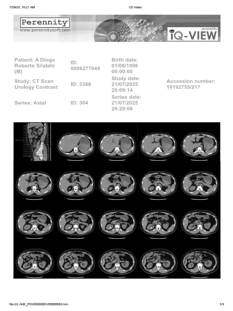 CT Scan 3 | PDF