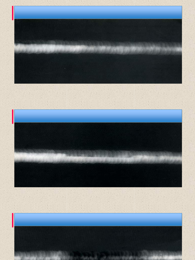 Radiographic Films | PDF