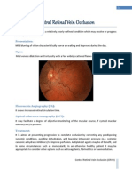 Non-Ischemic Central Retinal Vein Occlusion