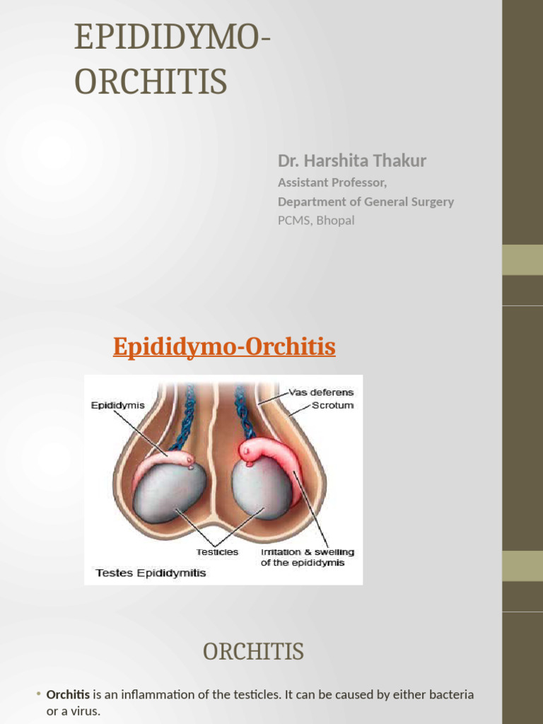 Understanding Epididymo-Orchitis Causes | PDF | Clinical Medicine | Urology