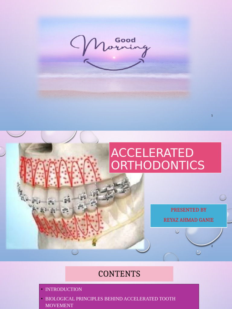 Accelerated Orthodontics Techniques | PDF | Human Tooth | Orthodontics