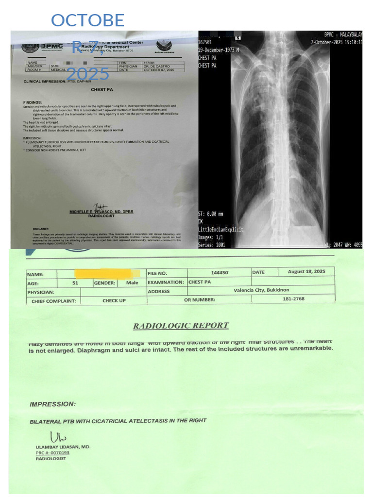 X Ray | PDF