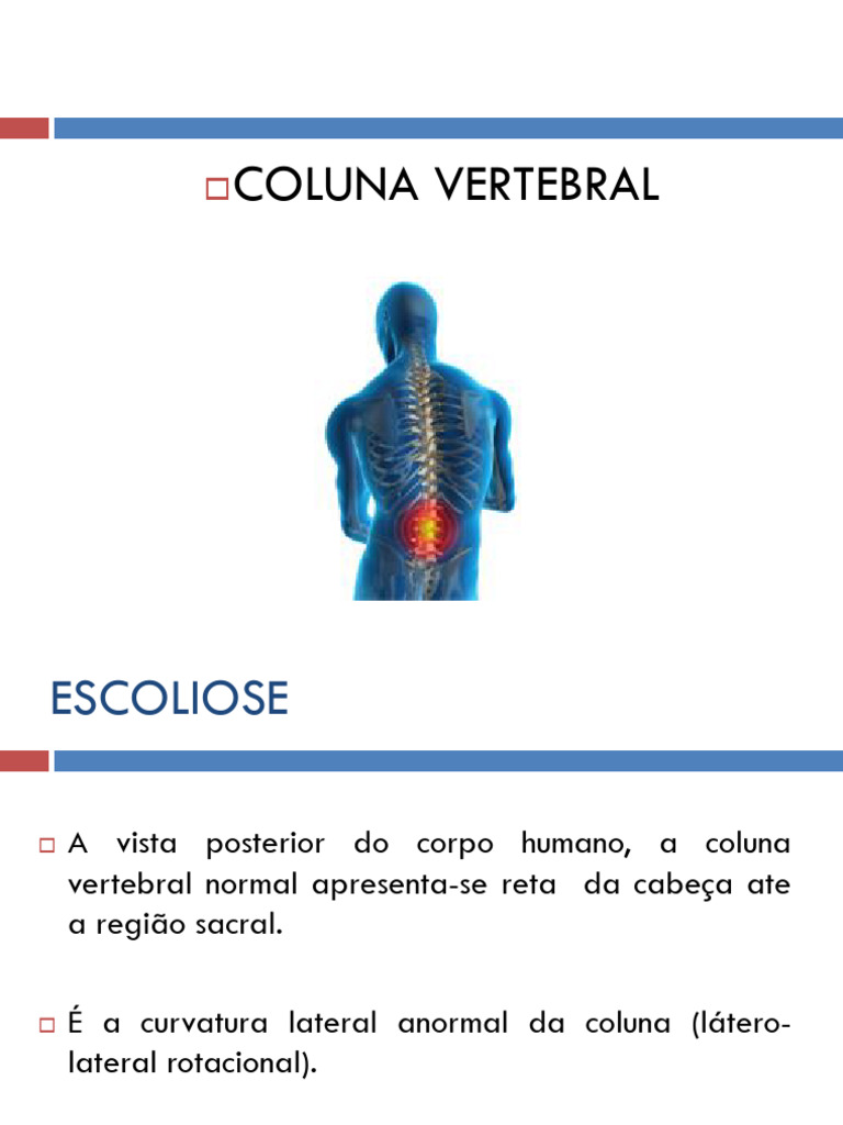 Escoliose e Doenças da Coluna Vertebral | PDF | Escoliose | Doenças e ...