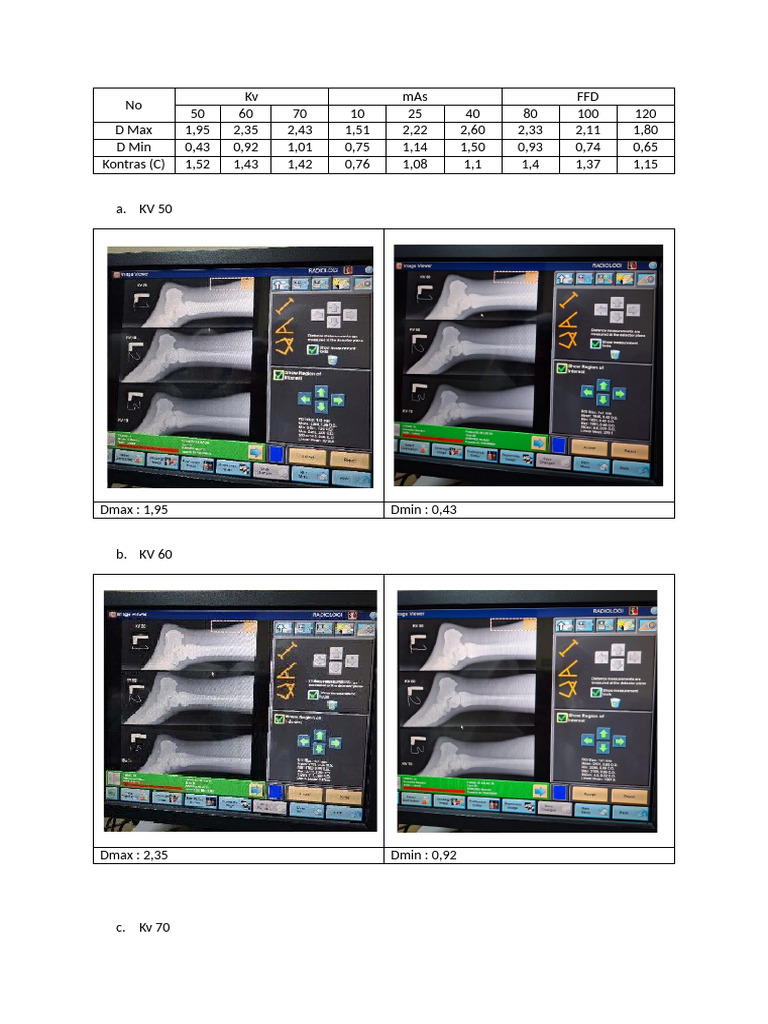 X-Ray Parameters: Dmax and Dmin Data | PDF