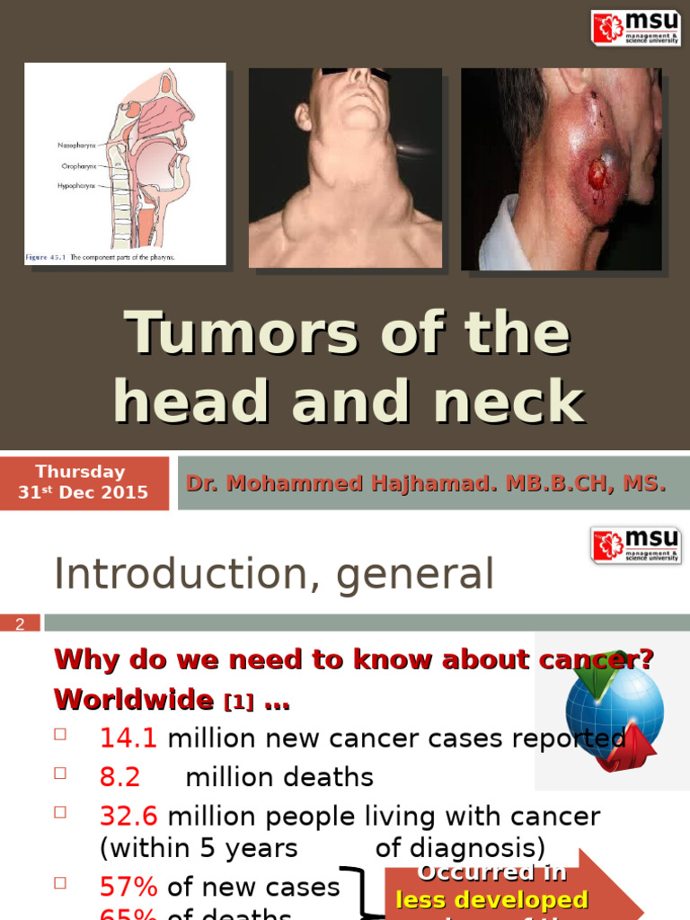 Head and Neck Tumors Overview | PDF | Head And Neck Cancer | Adenoma