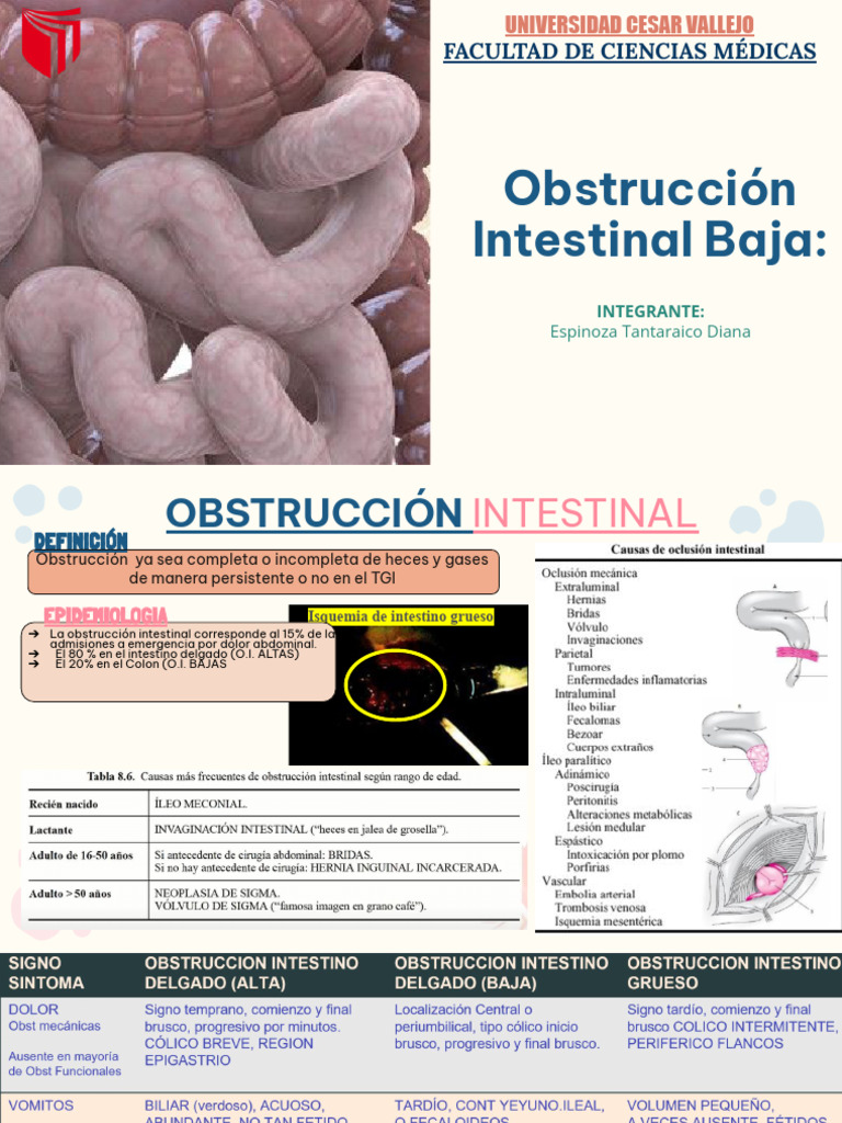 Obstrucción Intestinal Baja: Volvulo y Tratamientos | PDF | Tracto ...