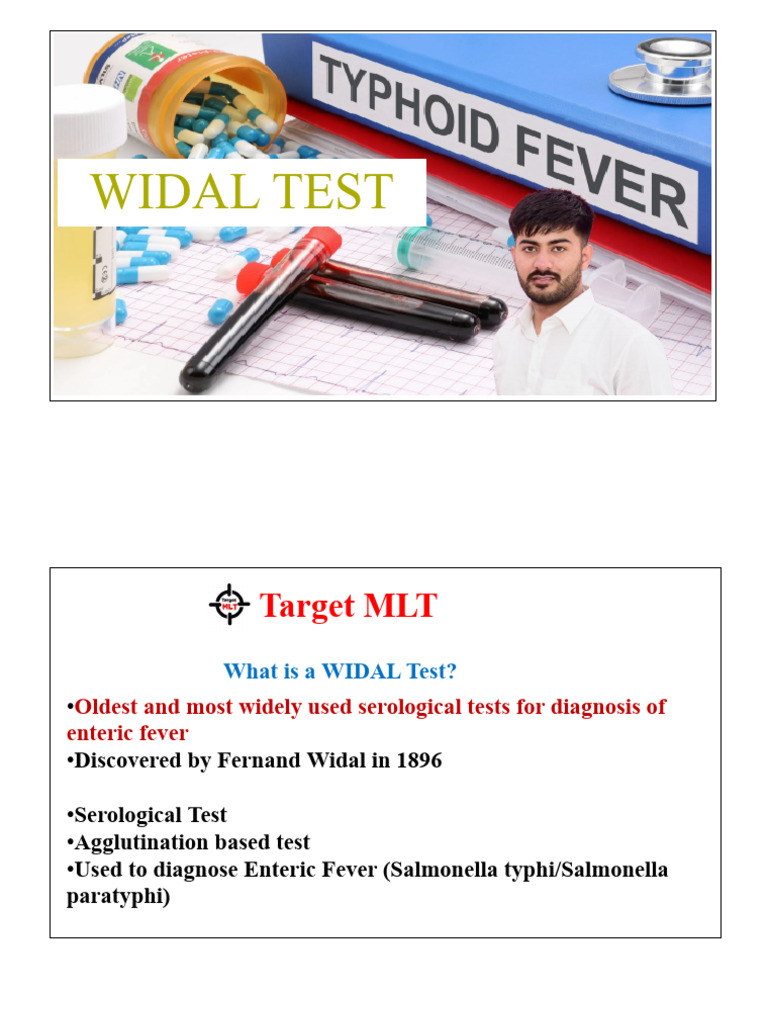 Widal Test | PDF
