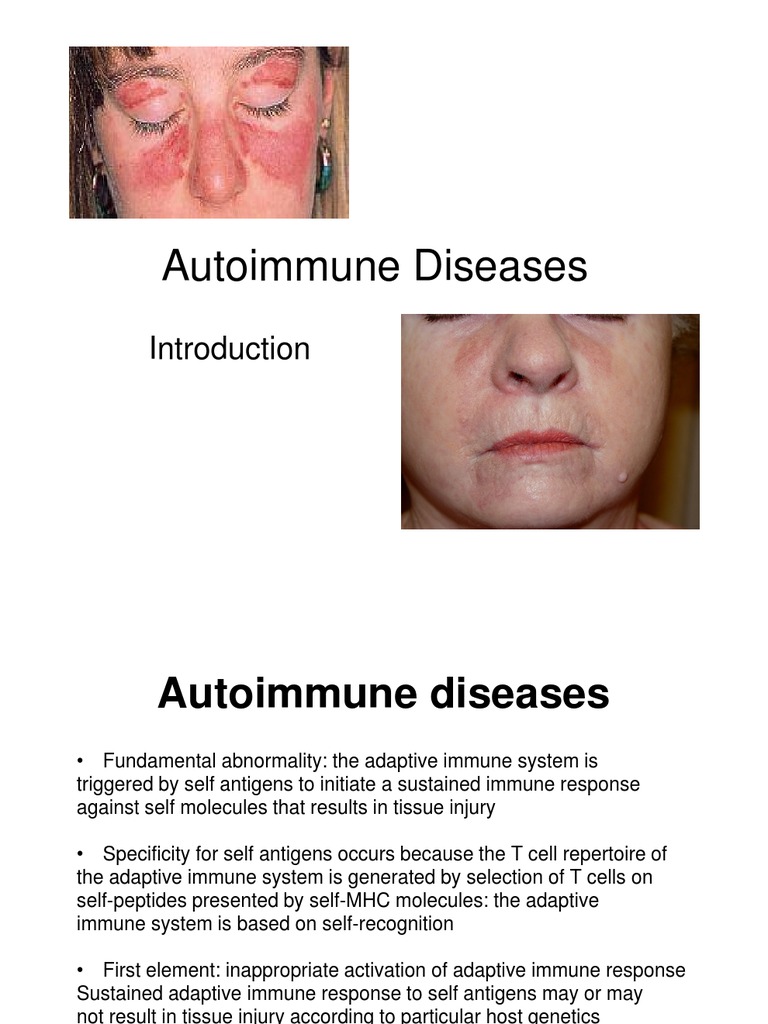 Autoimmune Diseases | PDF | Autoimmunity | Autoimmune Disease