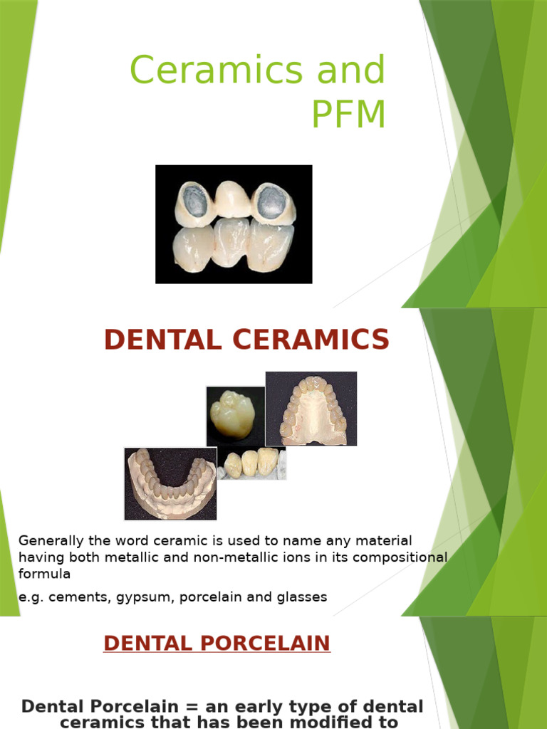 Dental Ceramics and PFM Overview | PDF | Aluminium Oxide | Glasses