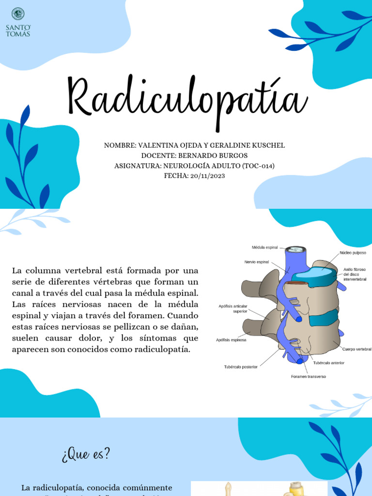 Radiculopatía: Causas y Tratamientos | PDF | Dolor | Médula espinal
