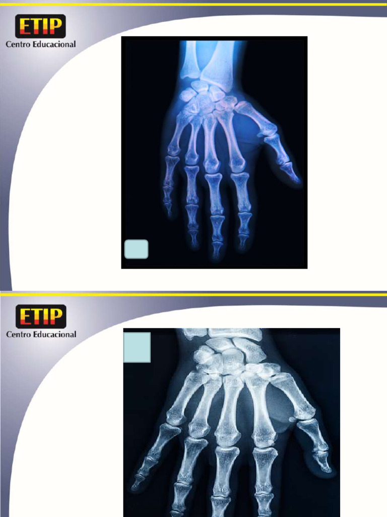 Compilado de Anatomia Radiologica MMSS | PDF