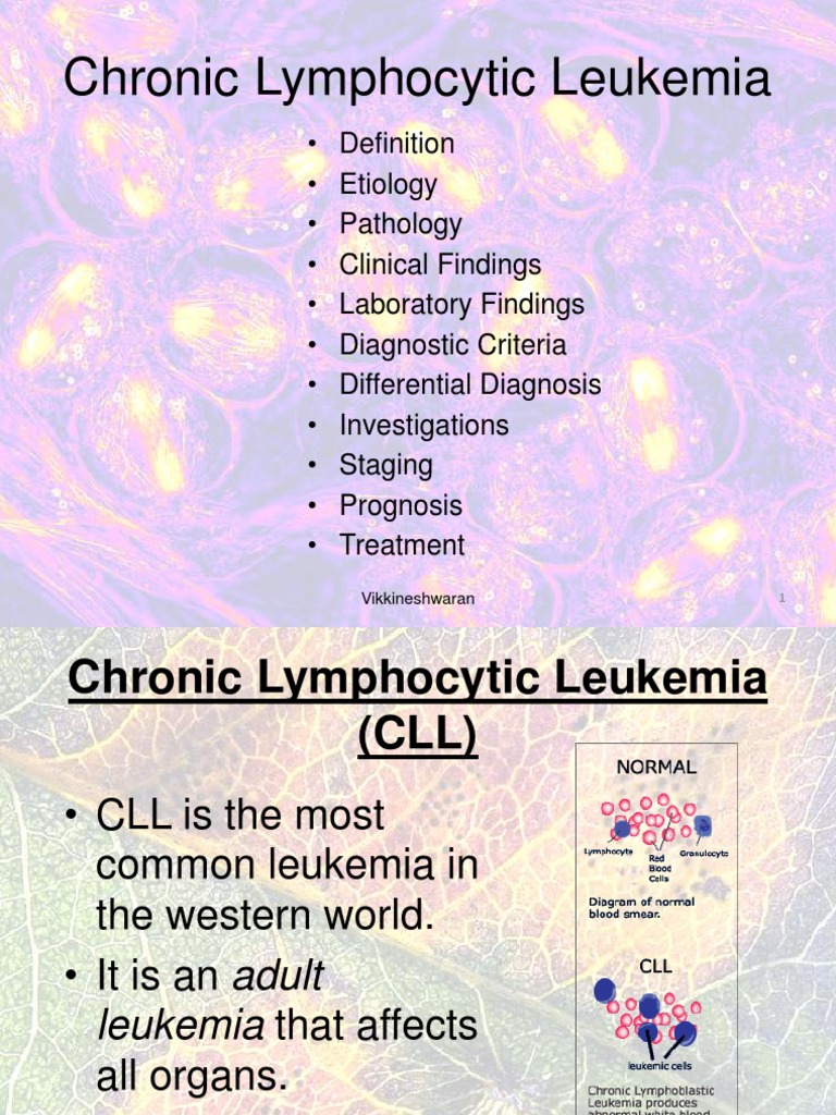 Understanding Chronic Lymphocytic Leukemia | PDF | Leukemia | B Cell