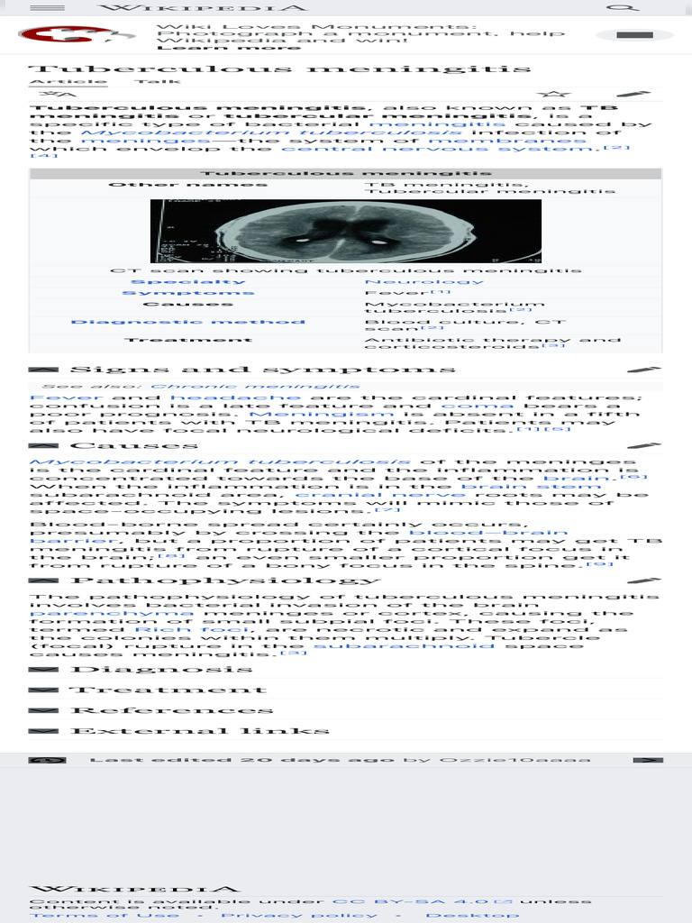 Tuberculous Meningitis - Wikipedia | PDF