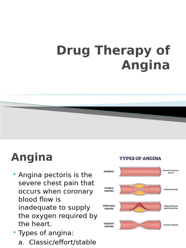 Drug Therapy of Angina R25 | PDF | Cardiovascular System | Clinical ...