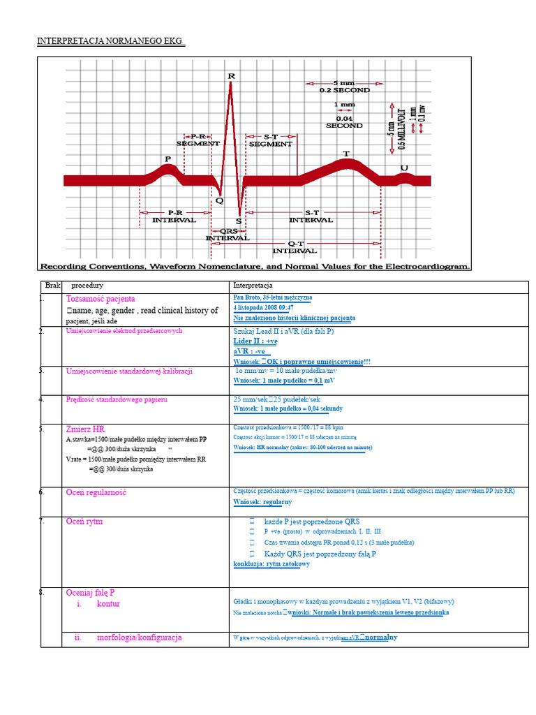 Interpretacja Prawidłowego EKG | PDF