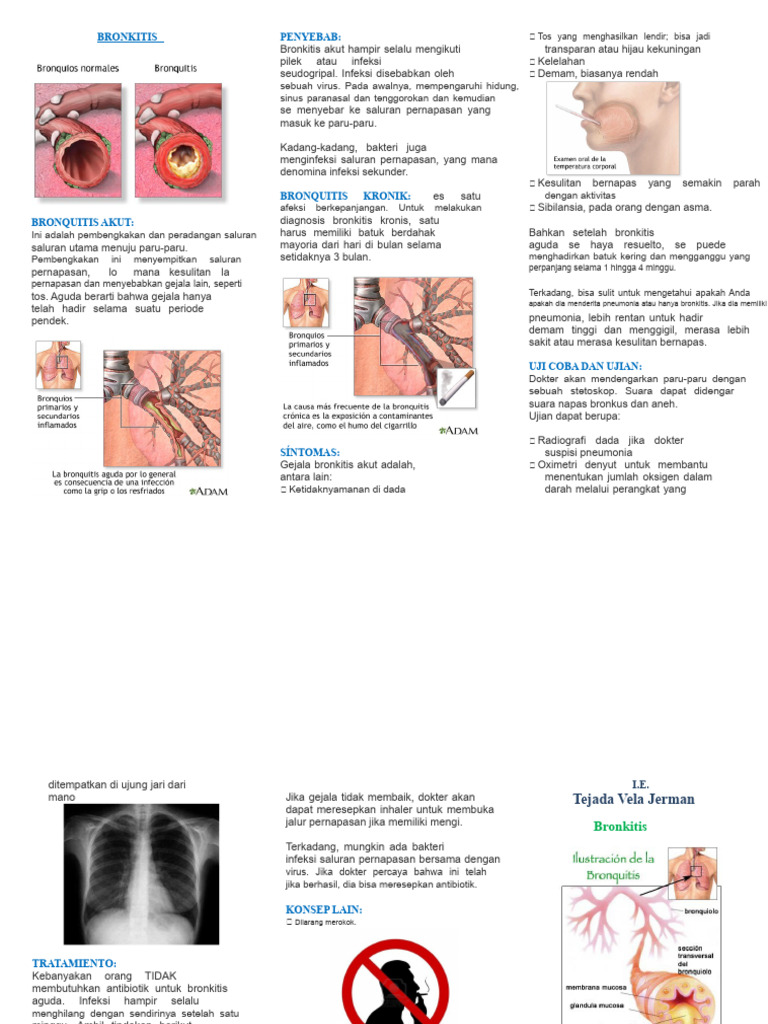 Panduan Lengkap tentang Bronkitis | PDF