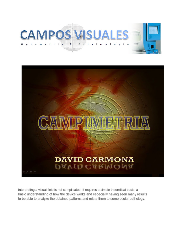 Visual Field Analysis and Interpretation | PDF | Sensitivity And ...