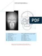 Rontgen Kepala