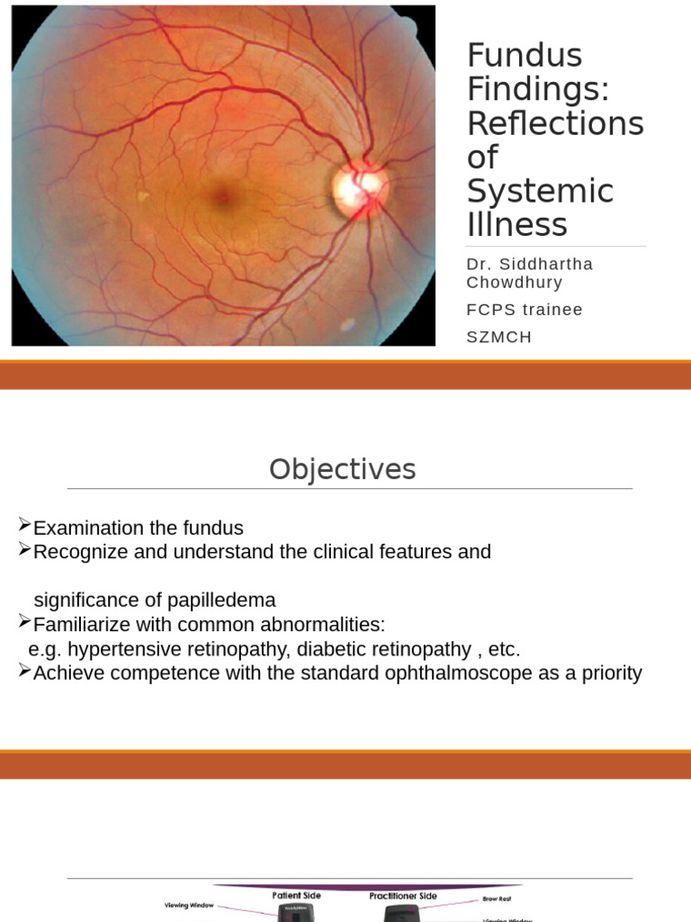 Fundus Examination and Findings Guide | PDF | Retina | Blood Vessel