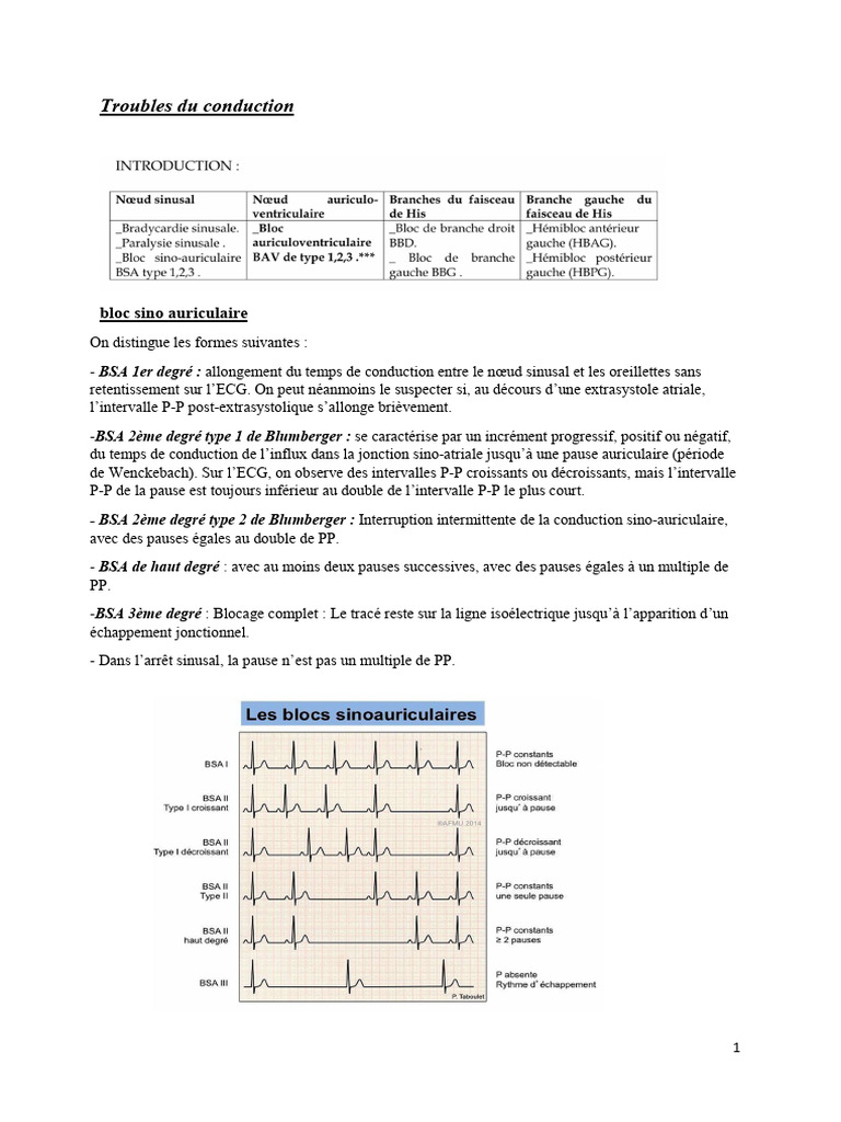 Troubles de conduction cardiaque expliqués | PDF | Atrium (anatomie ...