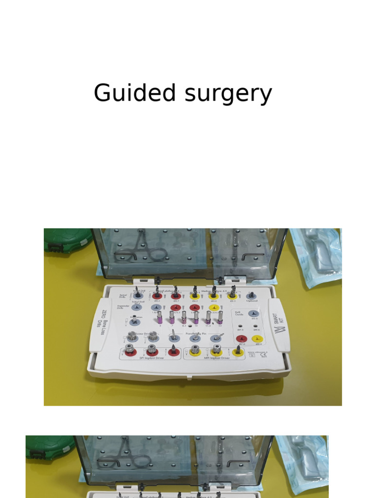 Guided Surgery | PDF