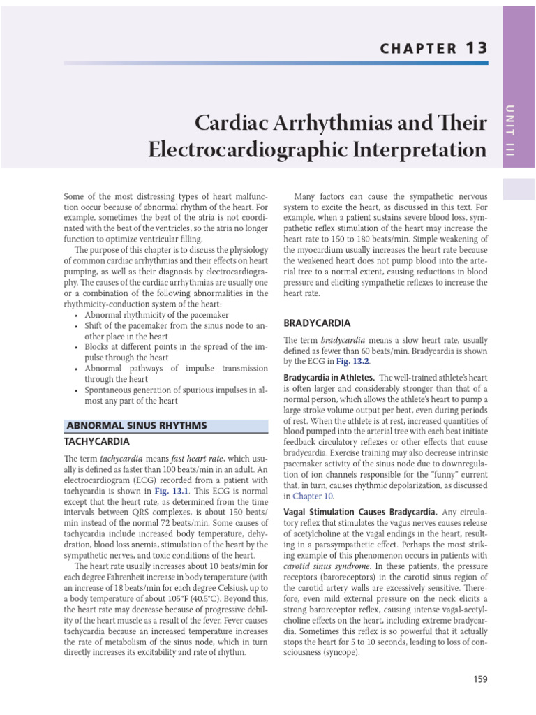 Cardiac Arrhythmias and ECG Insights | PDF | Heart | Electrocardiography