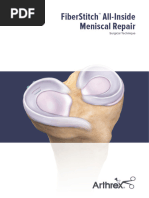 Knee FiberTak Anchor System Overview | PDF | Surgical Suture | Knee