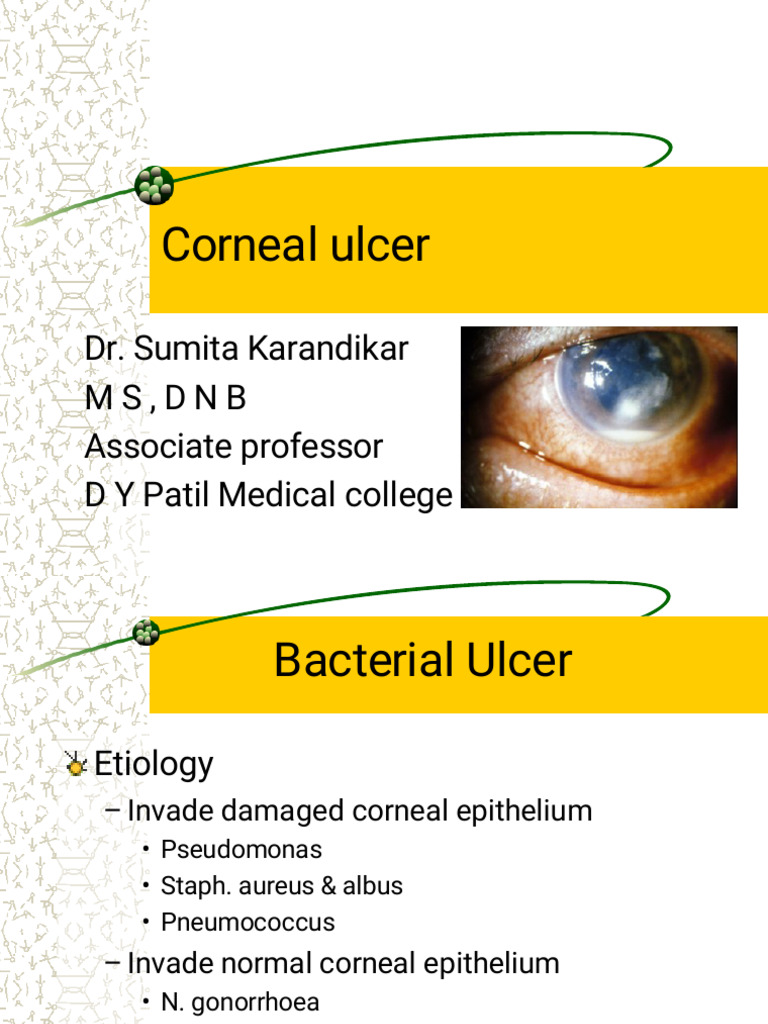 Understanding Corneal Ulcers: Causes & Treatment | PDF | Ophthalmology ...