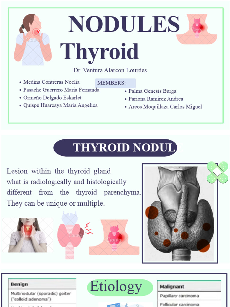 Multinodular Goiter Overview and Management | PDF | Thyroid | Thyroid ...