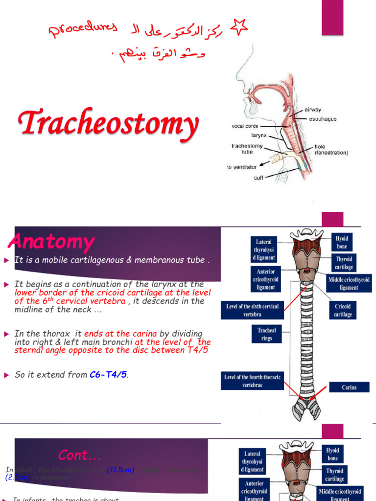 Tracheostomy Procedure Overview | PDF | Neck | Medical Specialties