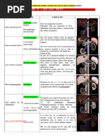 Temps d'injection en TDM et contrastes | PDF | Tomodensitométrie ...