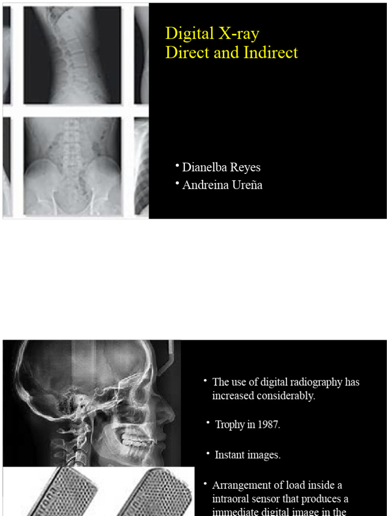 Direct vs Indirect Digital Radiography | PDF