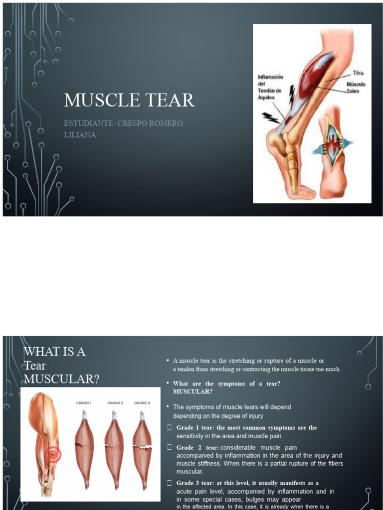 Understanding Muscle Tears: Symptoms & Recovery | PDF | Skeletal Muscle ...