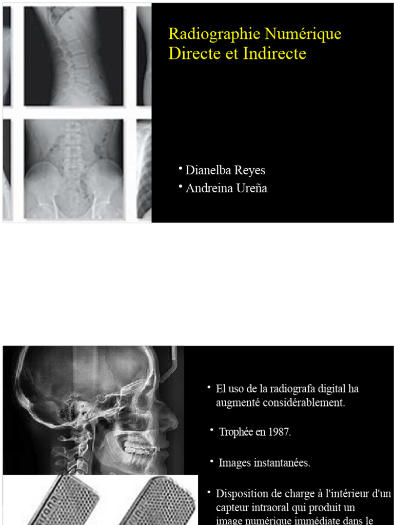 Radiographie Numérique : Directe vs Indirecte | PDF