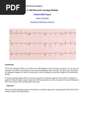 ECG Module Printable